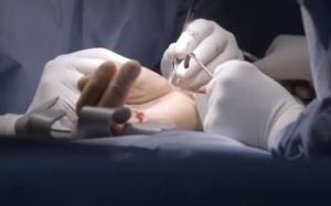 Capture d'écran de la vidéo : Urgences Mains Avicenne