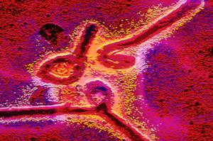 virus ebola